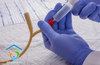 انجام سیستوستومی و تعبیه سوند در منزل
