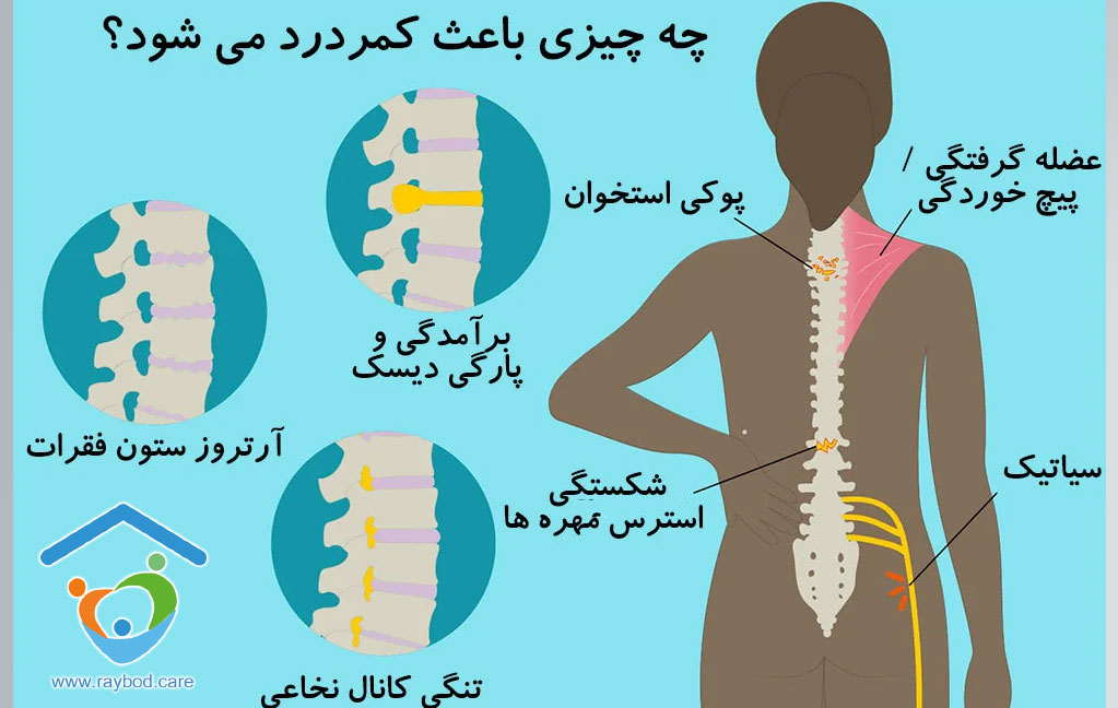 دلایل کمر درد